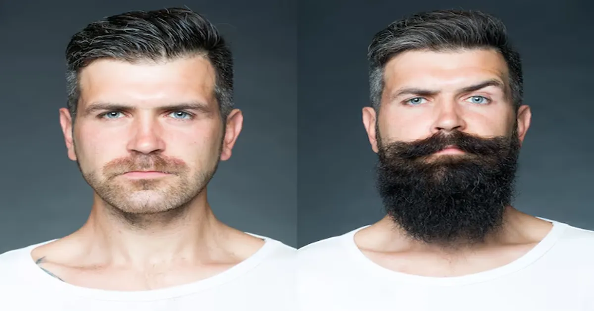 Minoxidil Beard